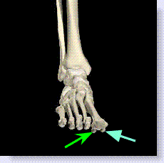 skeletalfront.gif