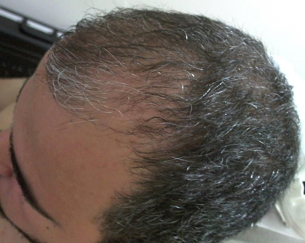  Antalya'da en iyi 'Saç Ekim Merkezi' hakkında bilgisi olan?